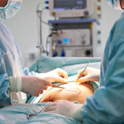 cicatrice addominoplastica